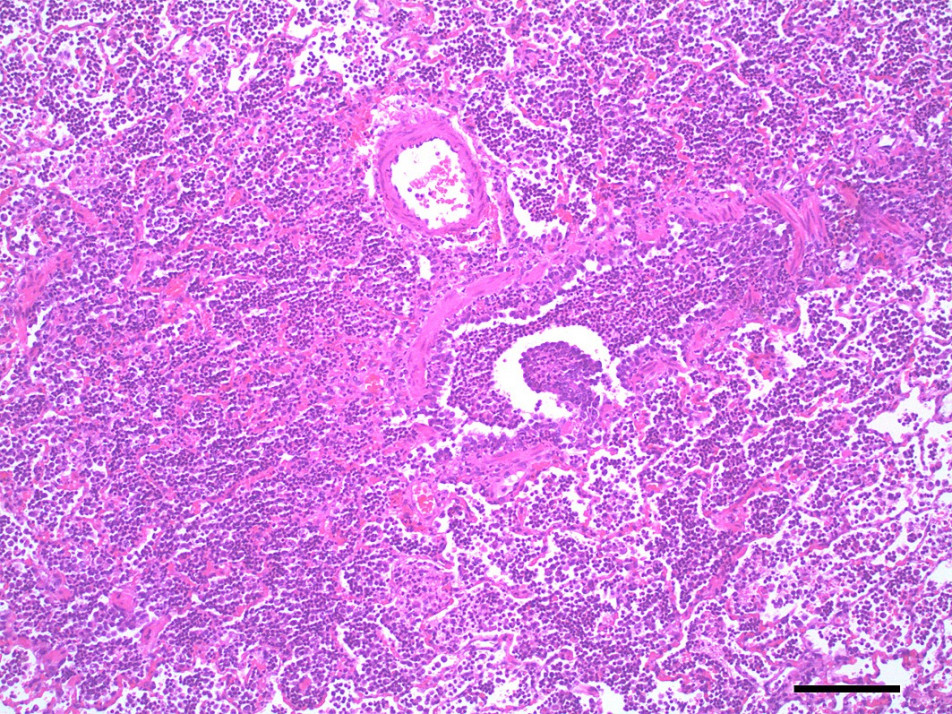 Lung histopathology